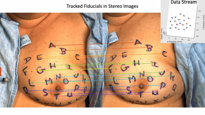 Stereo camera images with fiducials identified.